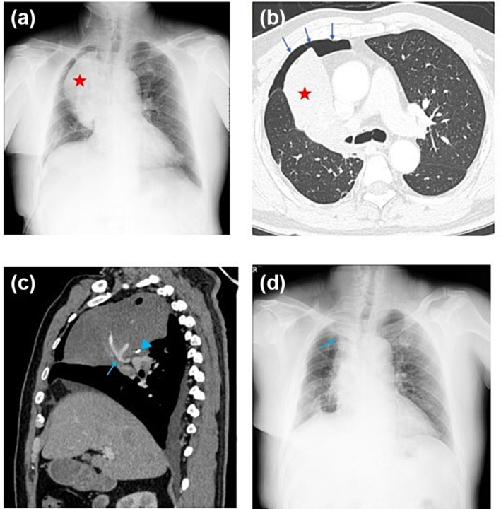 FIGURE 3