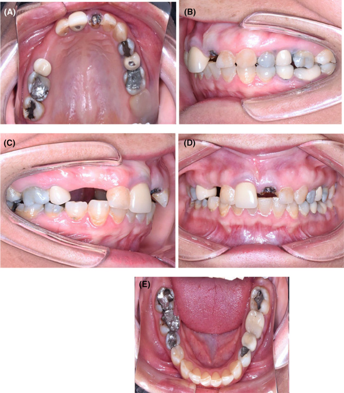 FIGURE 2