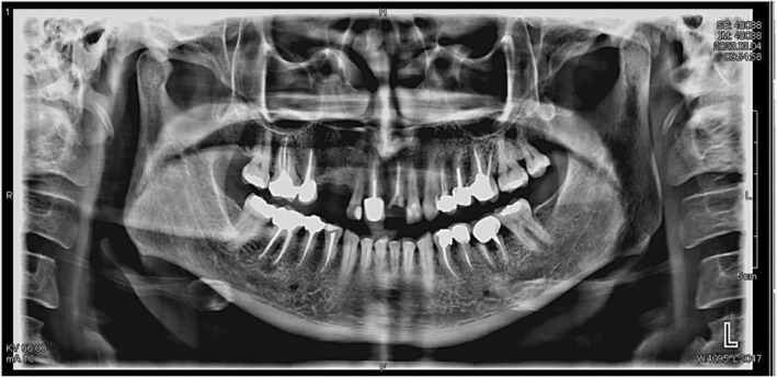 FIGURE 1