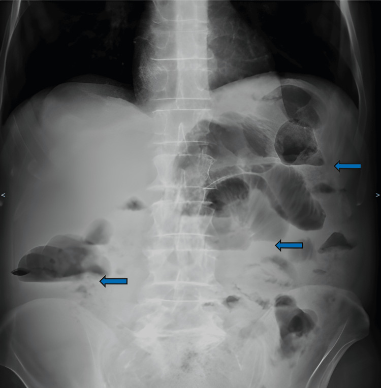 Figure 7