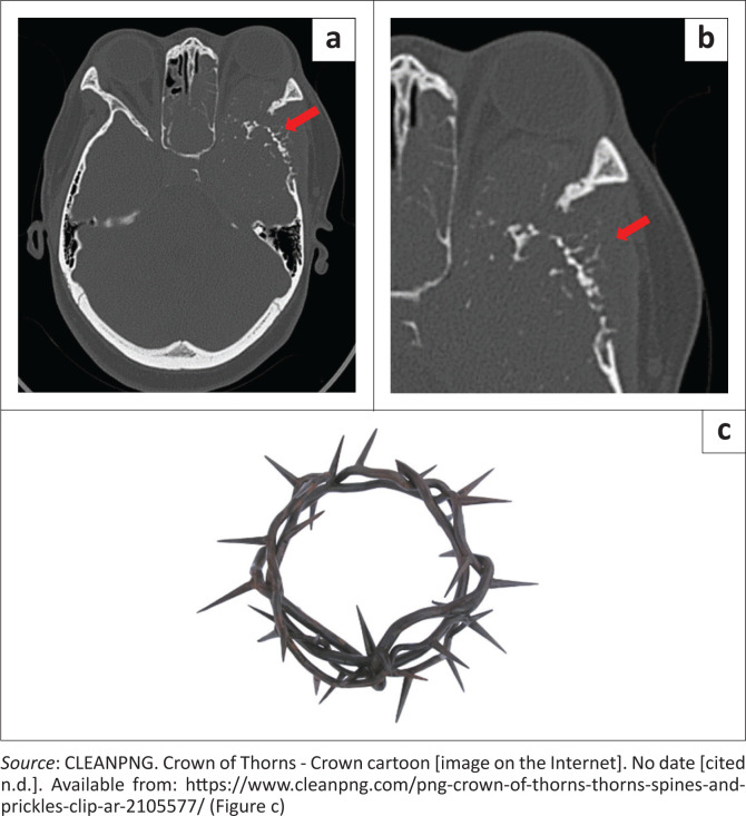 FIGURE 2