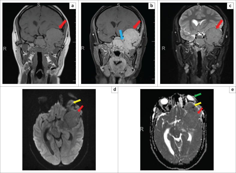 FIGURE 3