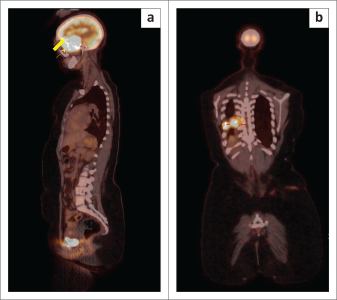 FIGURE 4