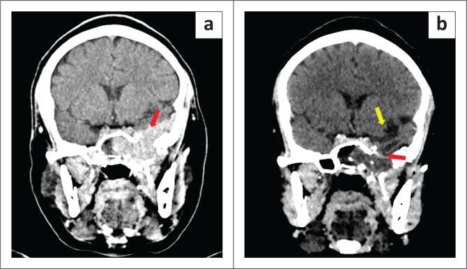 FIGURE 6
