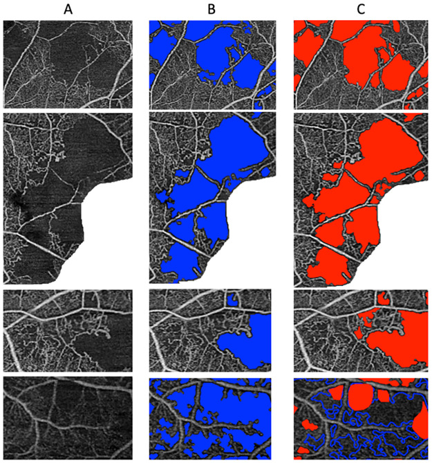Fig 4