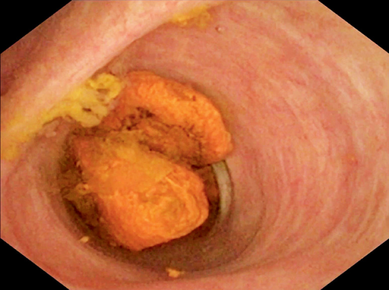Fig. 4