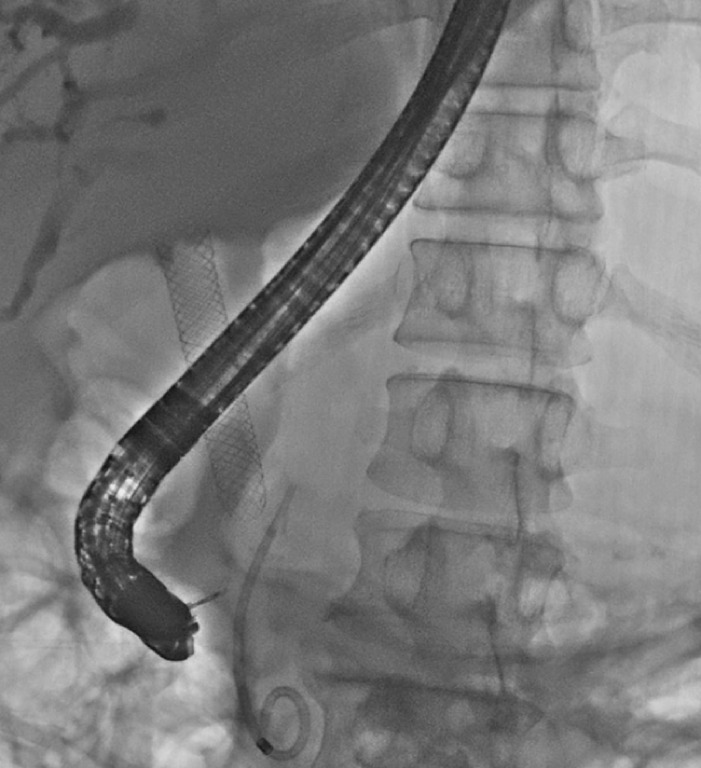 Fig. 4