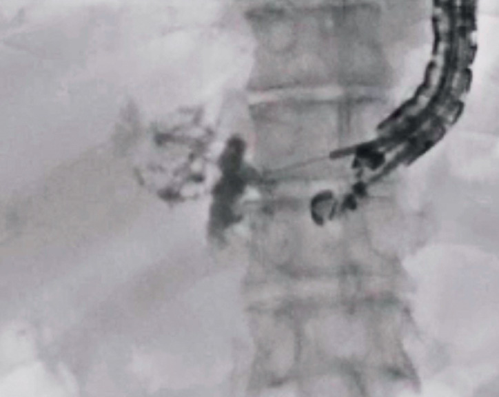 Fig. 2
