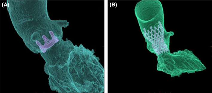 FIGURE 2