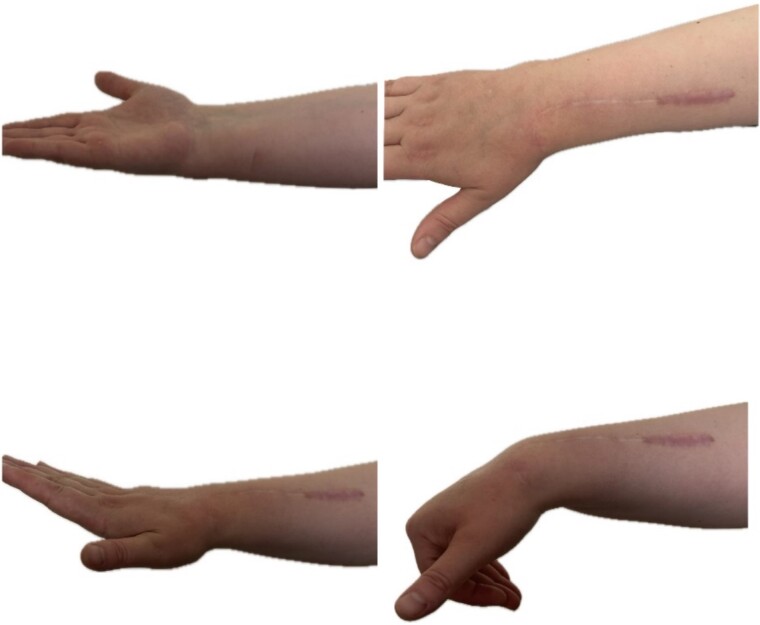 Figure 9