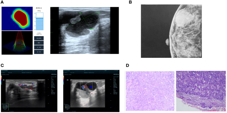 Figure 2
