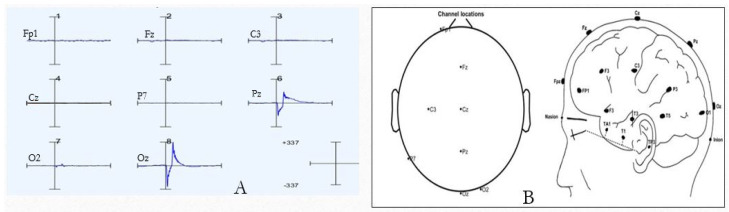 Figure 9