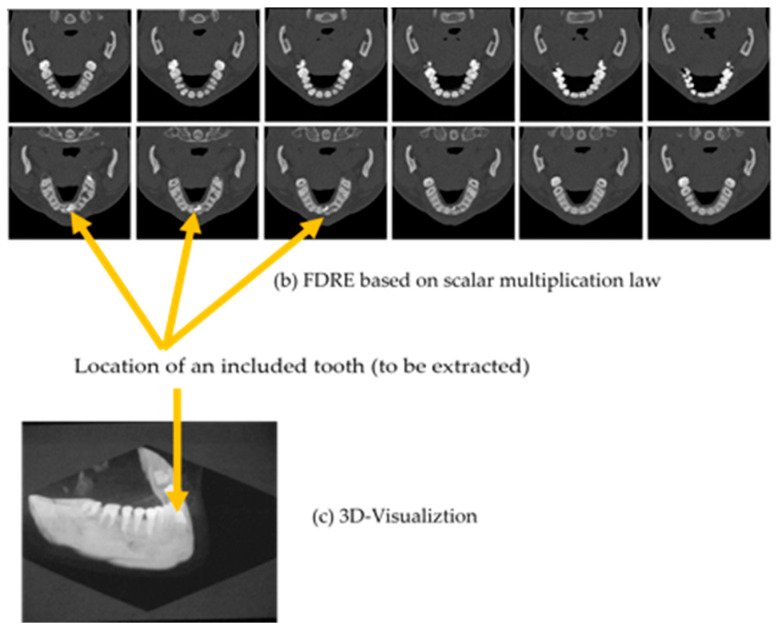 Figure 16