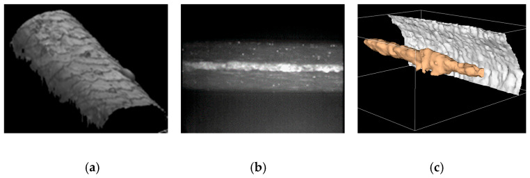 Figure 17