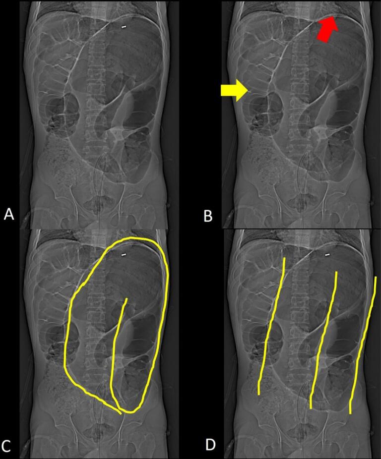 Figure 11