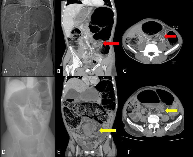 Figure 12