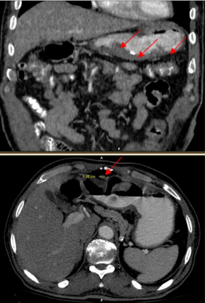 Figure 6