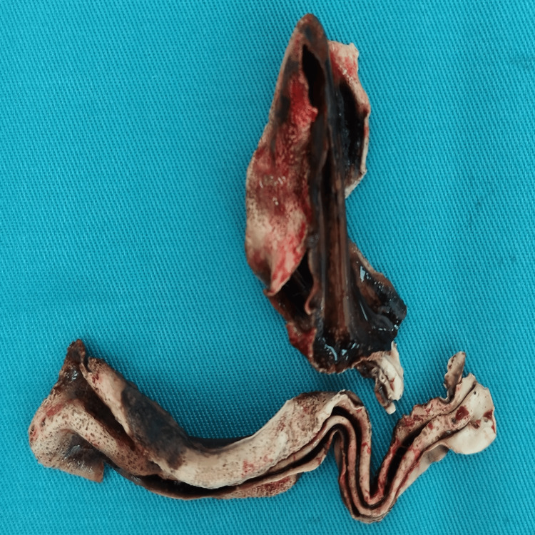 Figure 11