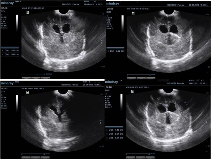 Figure 4