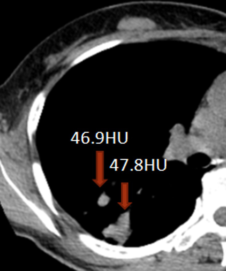 Figure 15