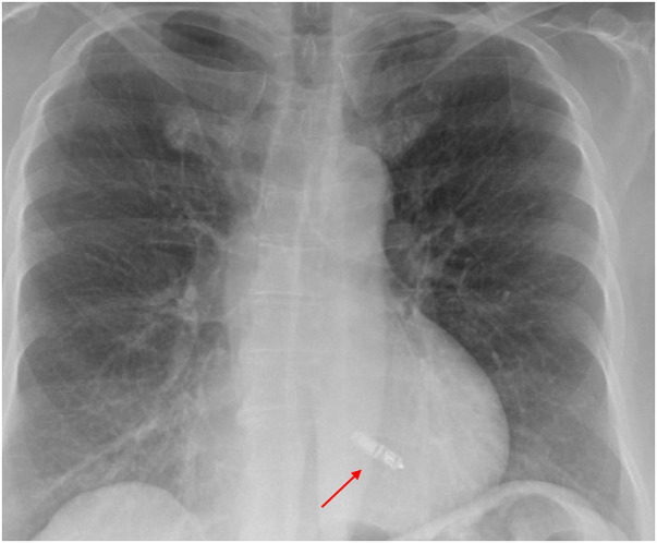 Figure 5
