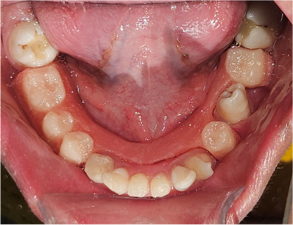 Figure 10