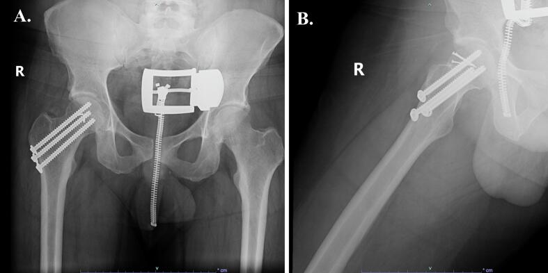 Figure 10