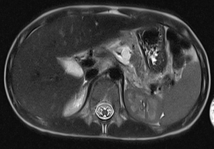 Fig. 2