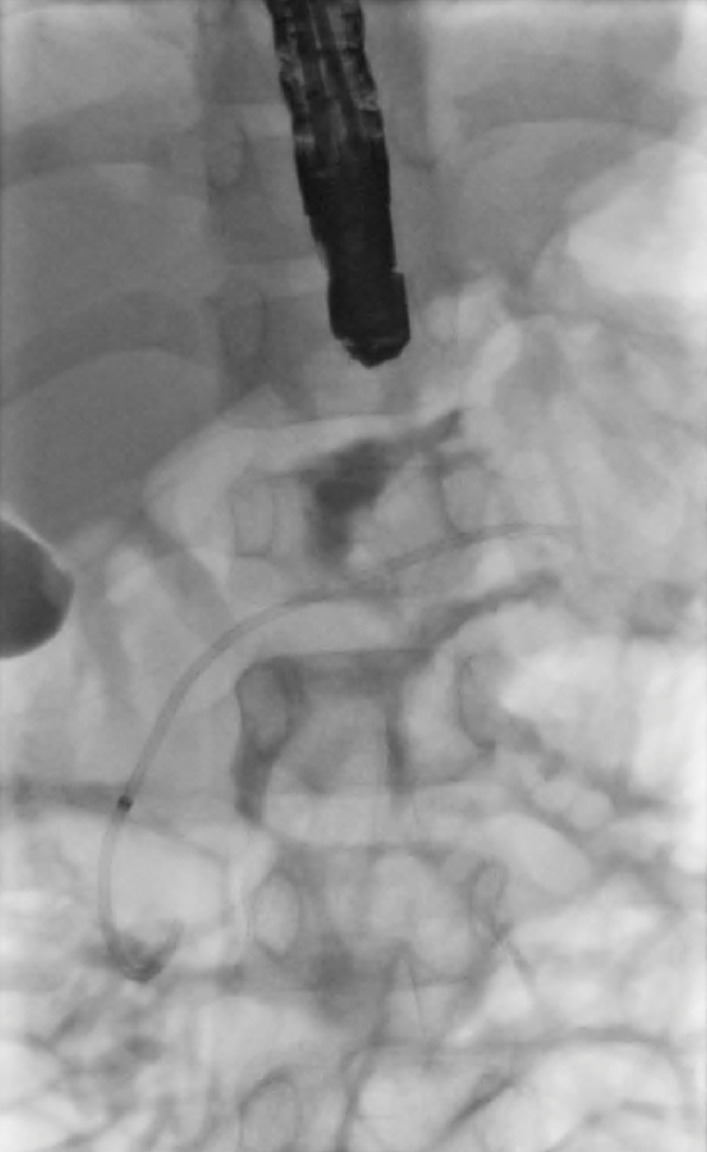 Fig. 4