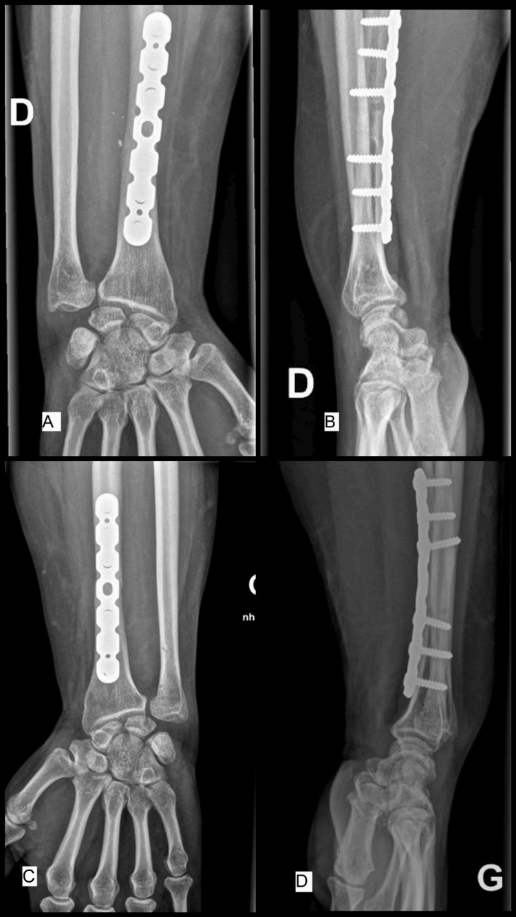 Figure 6