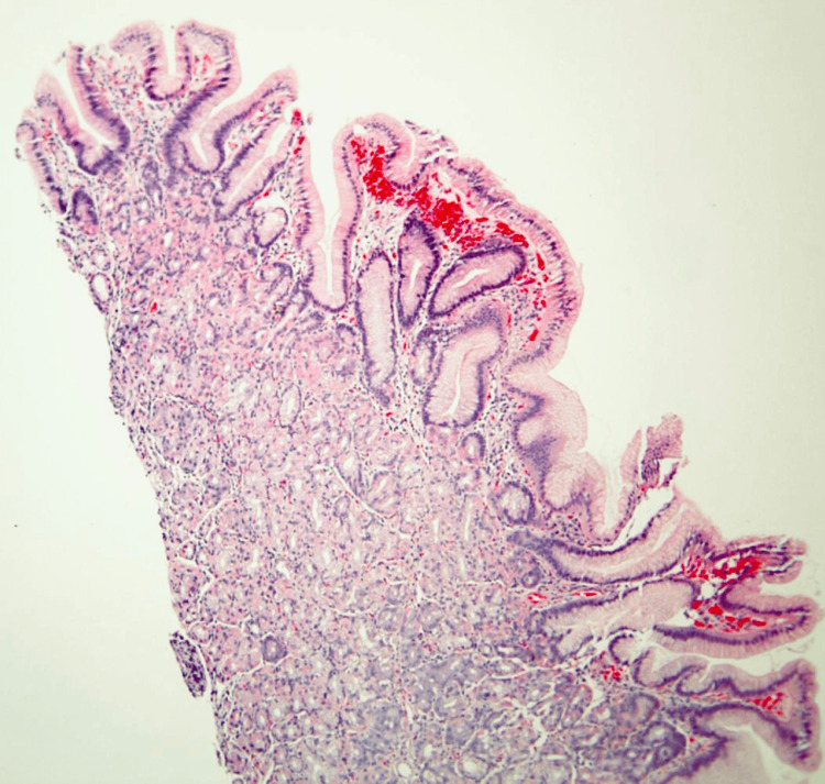 Figure 10