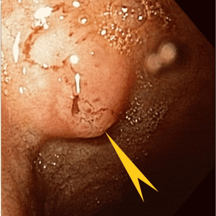 Figure 11
