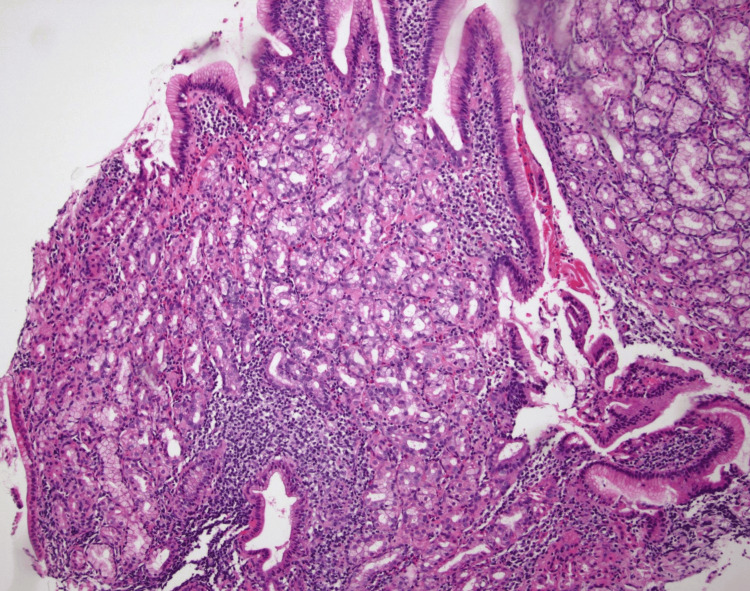 Figure 12