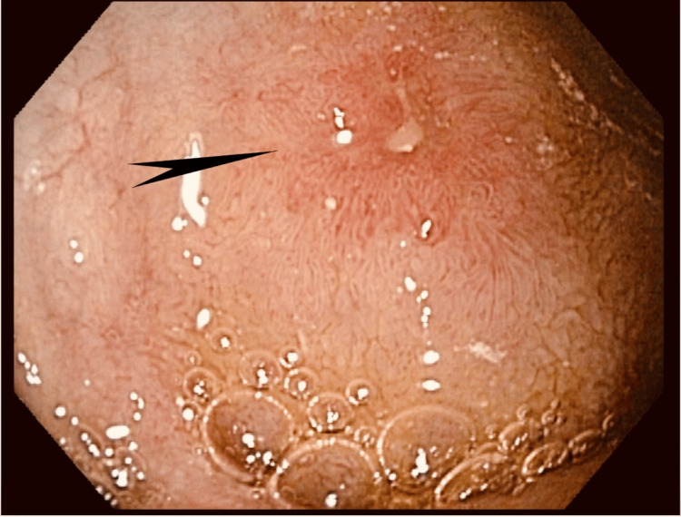 Figure 13