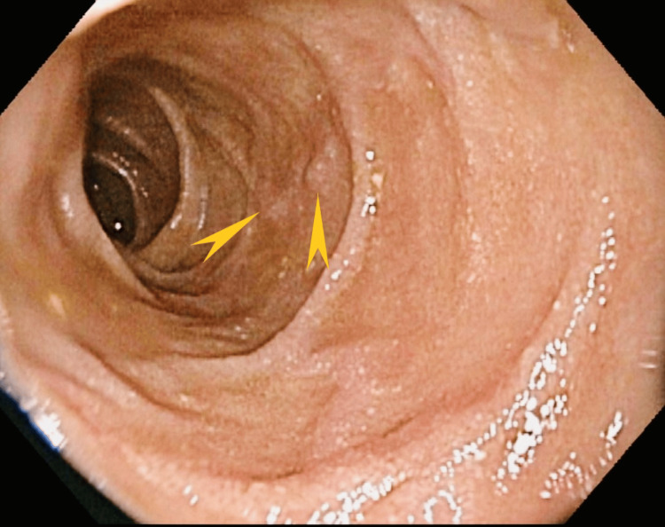 Figure 14