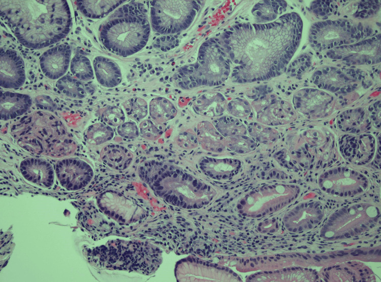 Figure 15