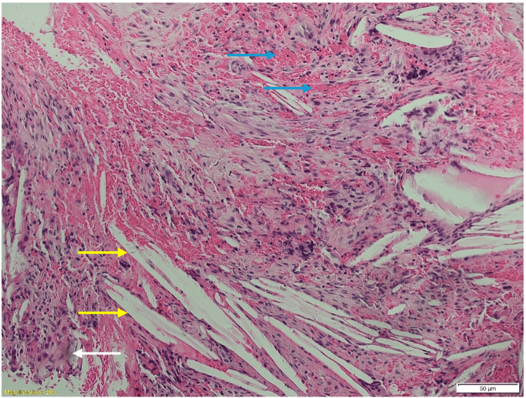 Figure 10