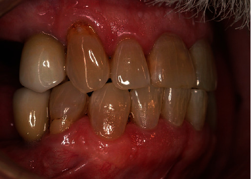 Figure 9