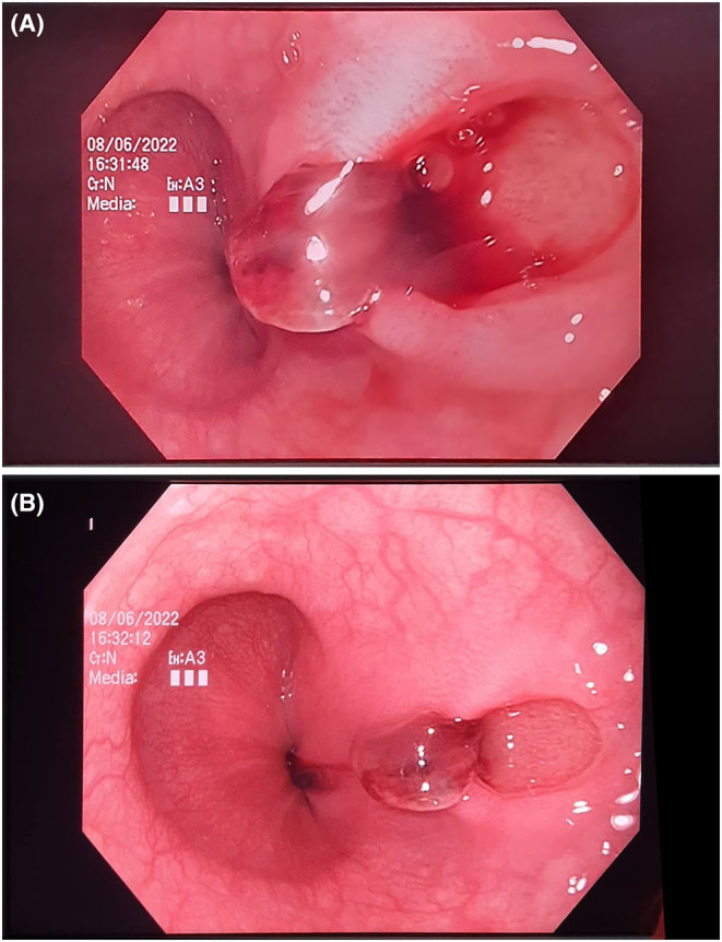 FIGURE 1