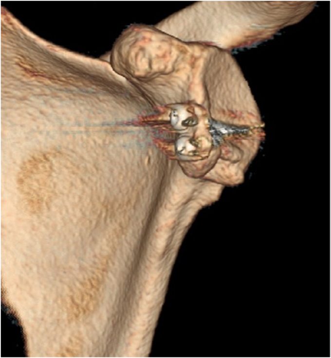 Figure 9