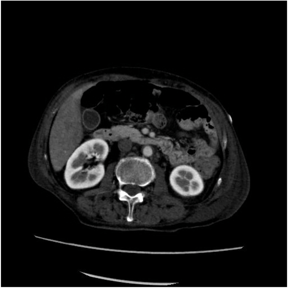 Figure 9