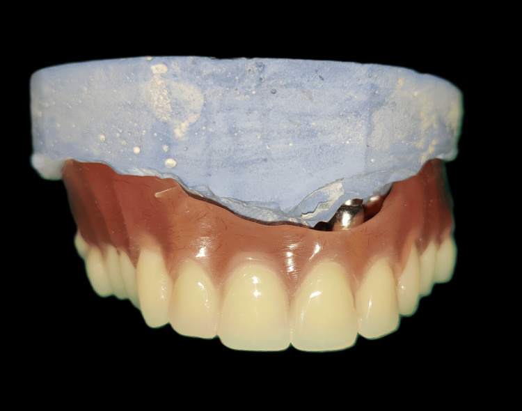 Figure 11