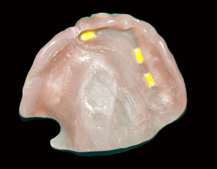 Figure 12