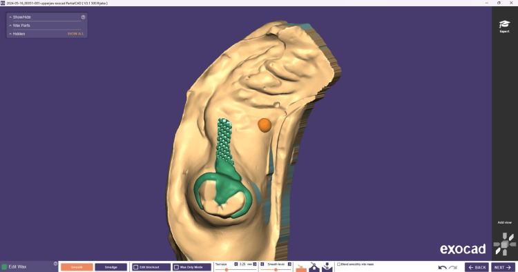 Figure 14