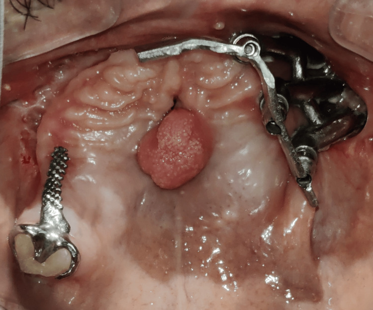 Figure 16