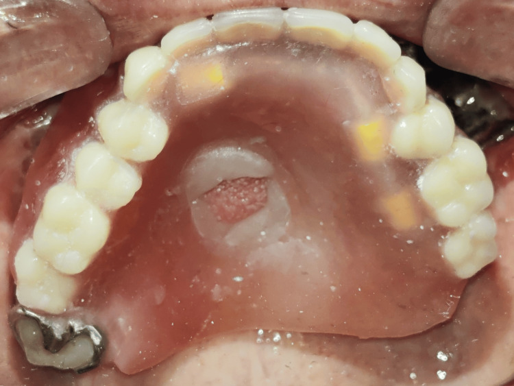 Figure 17