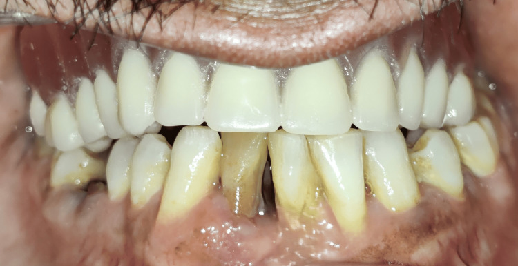 Figure 18