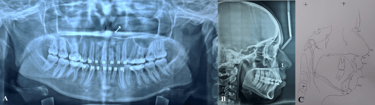 Figure 9