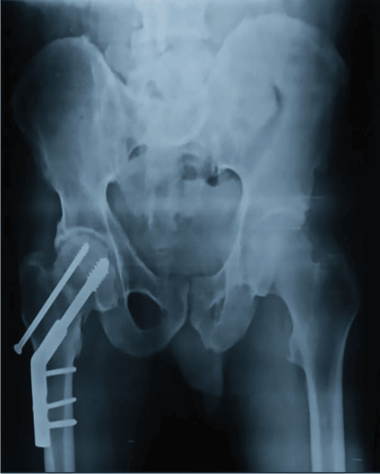 Figure 9