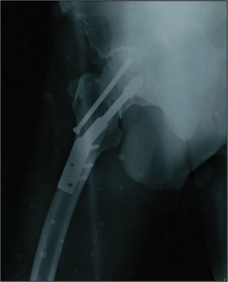 Figure 10
